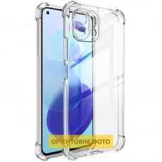 TPU чохол GETMAN Ease logo посилені кути Full Camera для Xiaomi Redmi 15 (Global)  Безбарвний (прозорий) - 00000082444_1