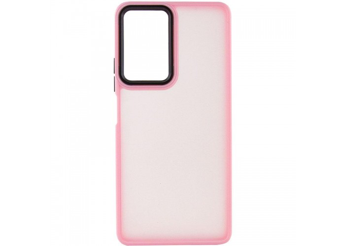 Чохол TPU+PC Lyon Frosted для Xiaomi Redmi 15 (EU)