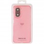 TPU чохол Nova для Xiaomi Redmi A5 (Europe version)